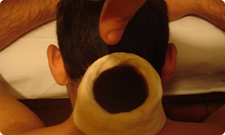  Kativasthi Treatment