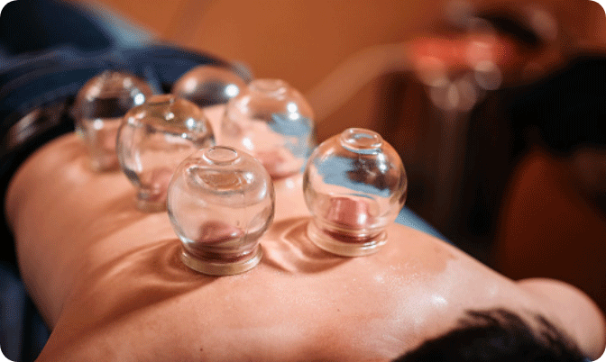 Hijama treatment in Abu Dhabi