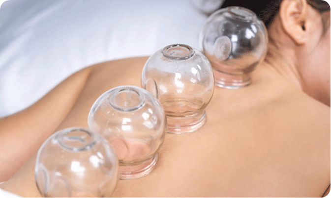 Hijama near me